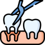 tooth-extraction